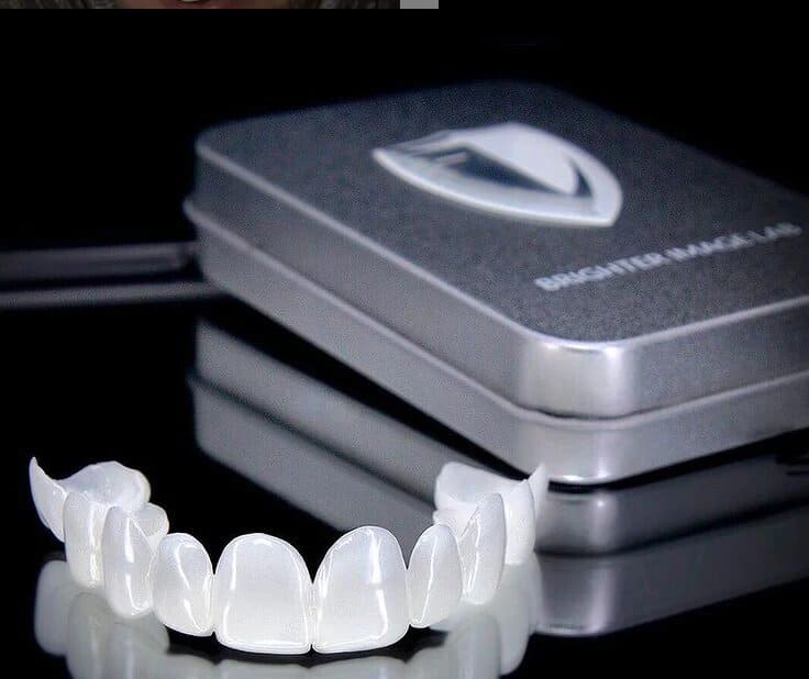 Lente Dental White 100% ajustable - Kit Superior + Inferior