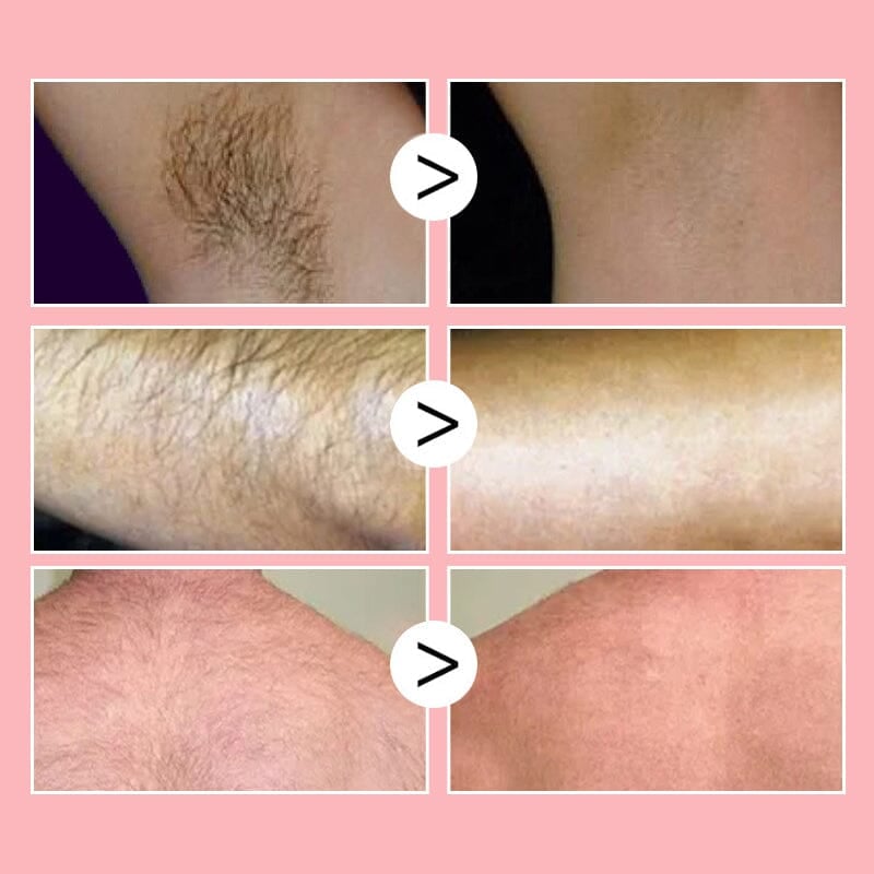 ✨Suave como la miel: spray depilatorio en mousse