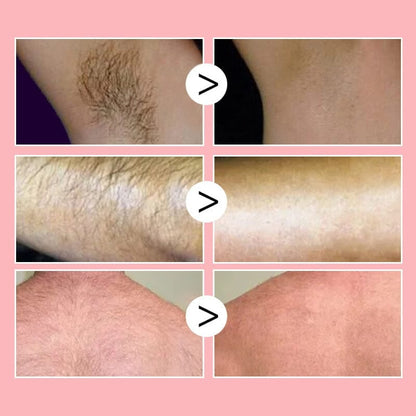 ✨Suave como la miel: spray depilatorio en mousse