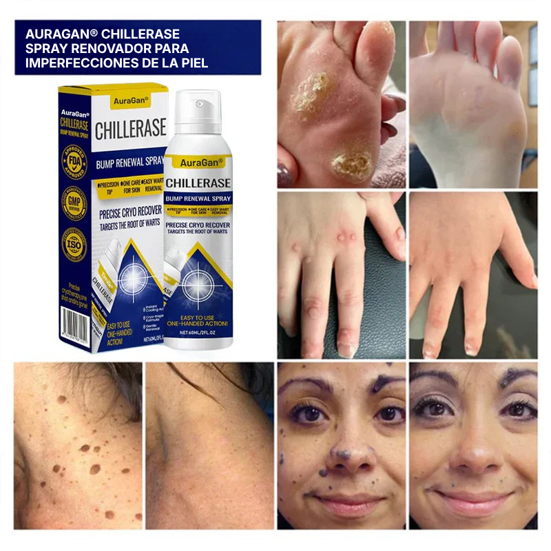 AuraGan® Spray Renovador de Piel