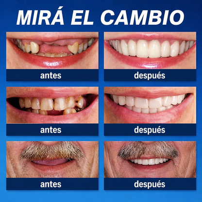 🎁🌎Ends Today: 70% OFF! ⏰meleval® Medical Full Denture with Strong Suctiond🦷Obtain American Dental Association (ADA) Certification