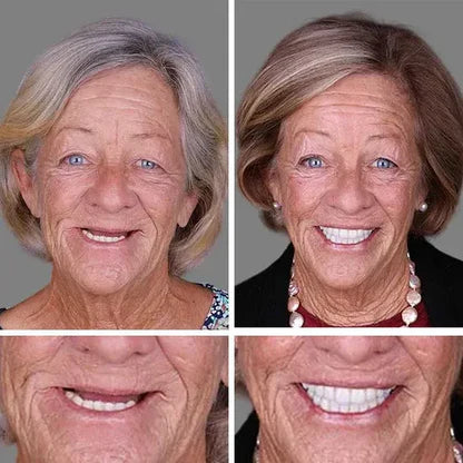 🎁🌎Ends Today: 70% OFF! ⏰meleval® Medical Full Denture with Strong Suctiond🦷Obtain American Dental Association (ADA) Certification